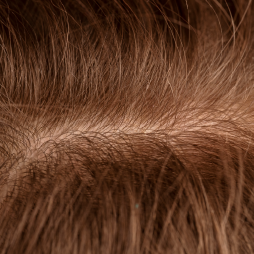 Microagulhamento Capilar e de barba: Um presente de cuidado para o Dia dos Pais!