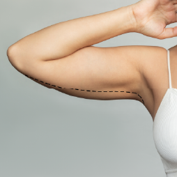 Entendendo a flacidez tissular