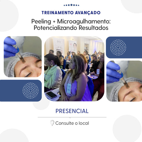 Peeling + Microagulhamento Potencializando