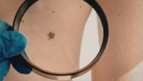 Abril: mês da saúde e o papel da estética no cuidado com a pele