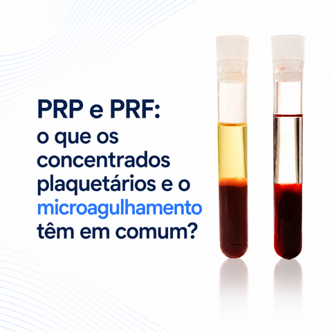 PRP e PRF: o que os concentrados plaquetários e o microagulhamento têm em comum?