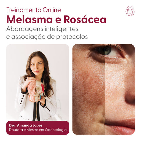 Melasma e Rosácea: Abordagens inteligentes e associação de protocolos