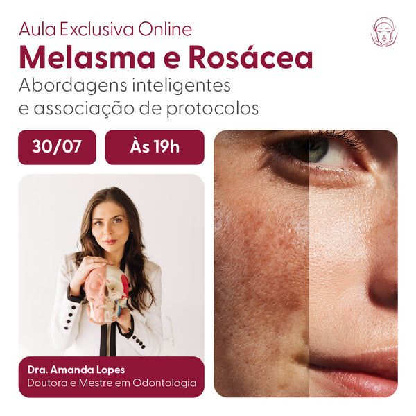 Melasma e Rosácea: Abordagens inteligentes e associação de protocolos